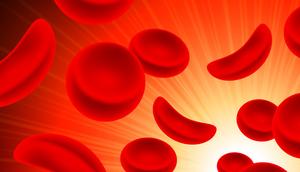 New drug for people with sickle cell [Harvardhealth]
