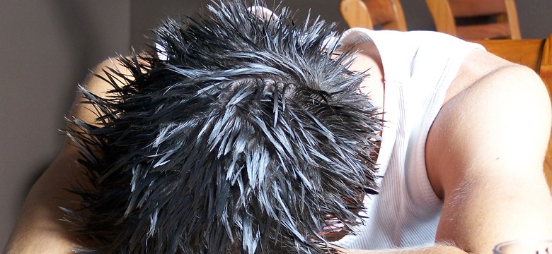 Kac? Co zrobić, by go nie mieć