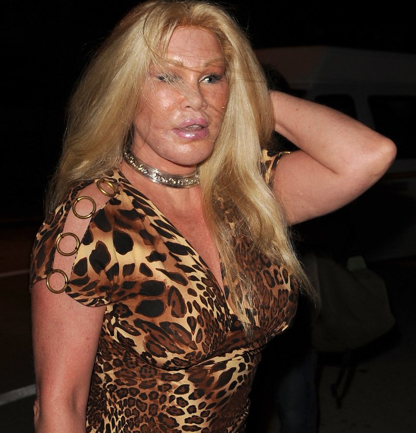 Jocelyn Wildenstein