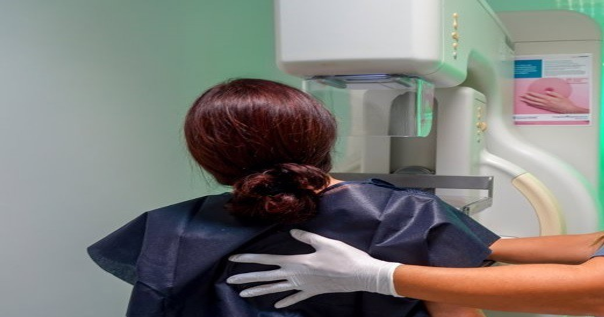 IU denuncia a 3 consejeros de Salud por errores en cáncer mama