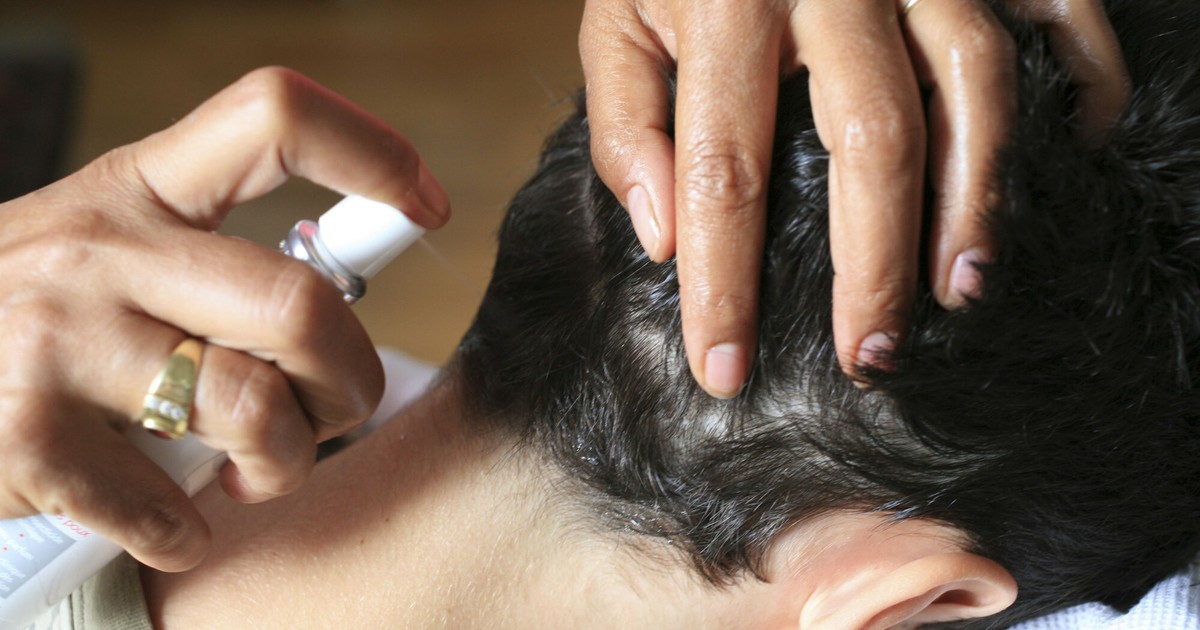 Vši ve školách.  Rekordní prodeje přípravků na vši