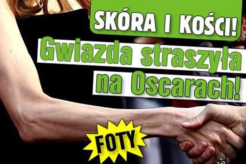 Skóra i kości! Gwiazda straszyła na Oscarach! FOTY