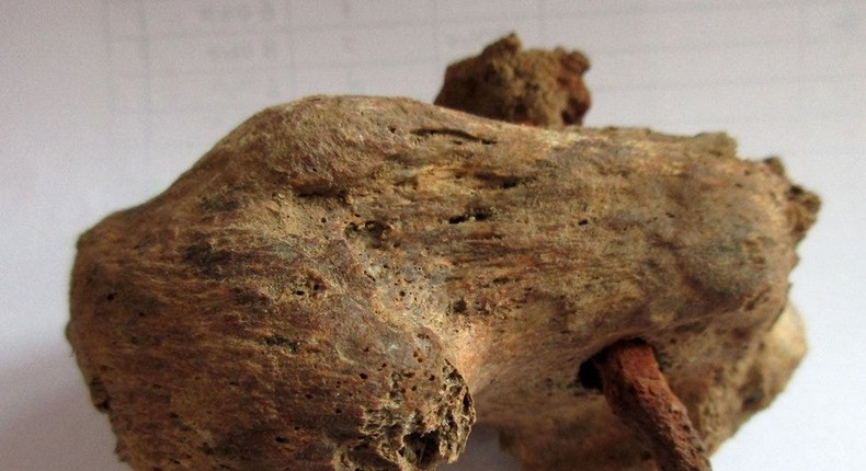 A nail was found in heel bone of ancient skeleton in England.