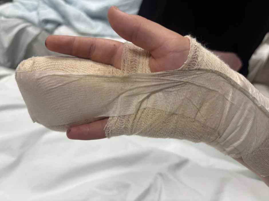 Dečaku iz Niša amputiran deo prsta