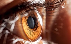 Niebezpieczna choroba oczu: JASKRA