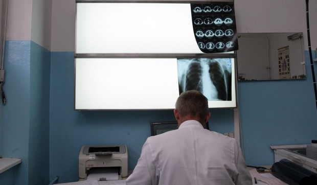 Klinika-za-plucne-bolesti