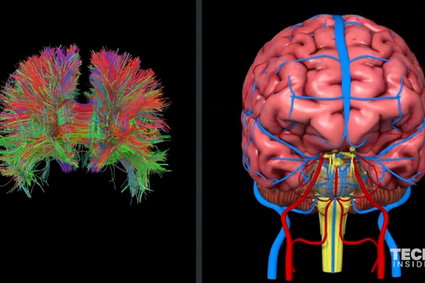 Naukowcy stworzyli hologram 3D połączeń w ludzkim mózgu