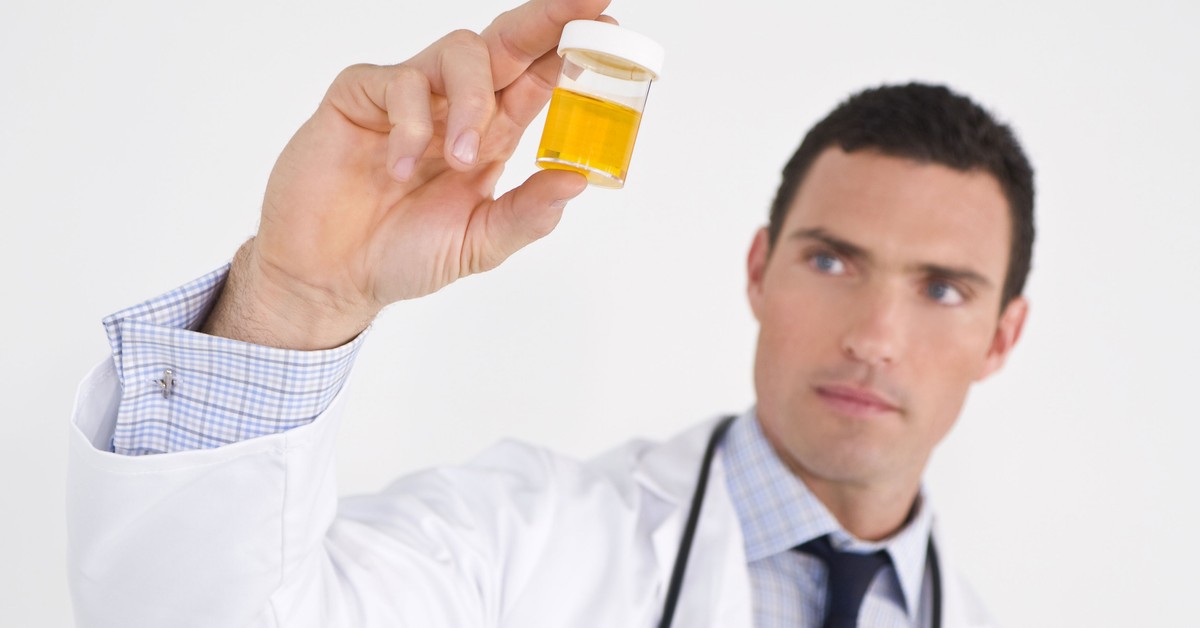 Badania moczu pracownika: kiedy są obowiązkowe i kto musi je wykonać?