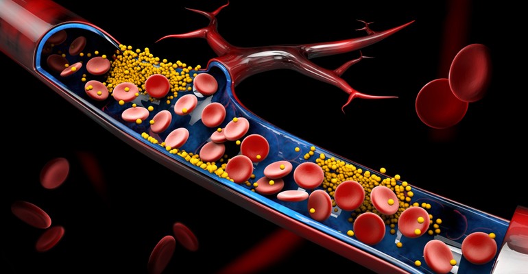 Cholesterol