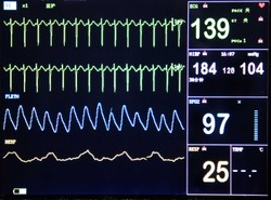 Wynalazek z Polski odmieni życie chorych na serce