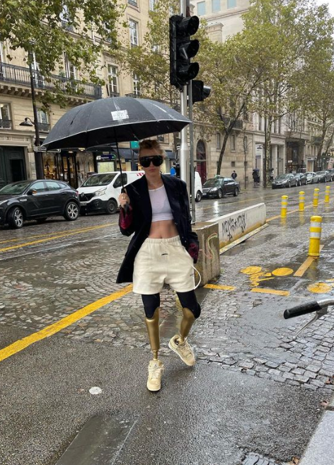 Krásna modelka prišla o obe nohy.