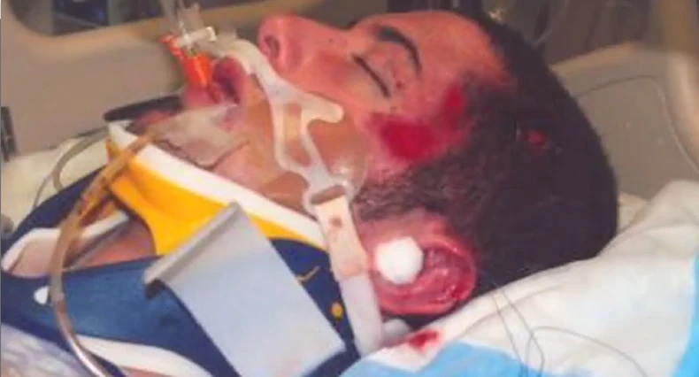 Tri meseca je proveo u komi