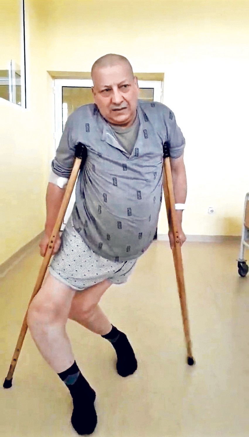 Pacijentu su kolena bila spuštena skoro do zemlje, a nakon samo dve operacije stoji potpuno uspravno