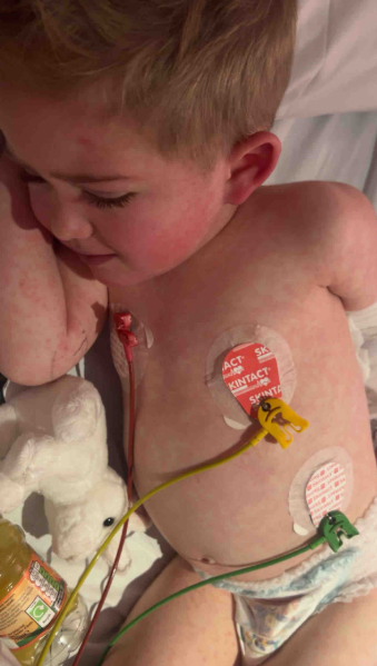 Elijah potrebuje transplantáciu kostnej drene.