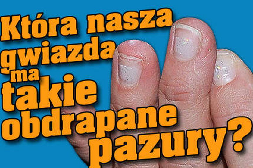 Która gwiazda ma takie potworne paznokcie?