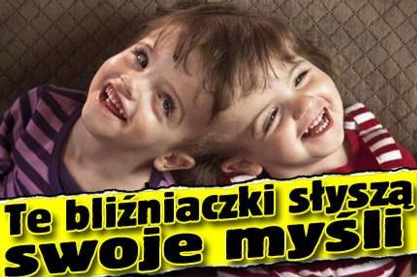 Te bliźniaczki słyszą swoje myśli