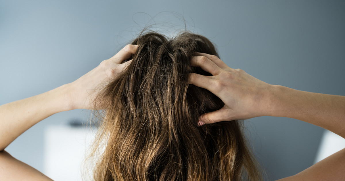 Czy włosy mogą boleć? Trichodynia to prawdziwa choroba i poważny problem