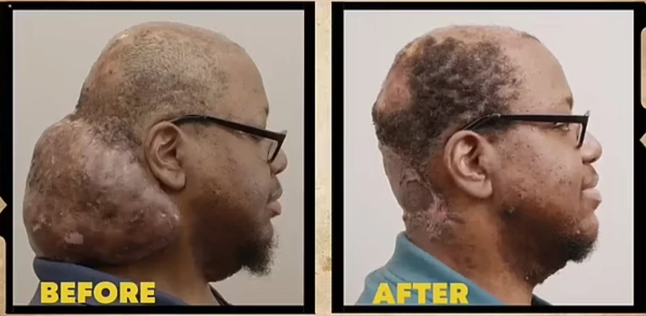 Arlin pre i posle operacije