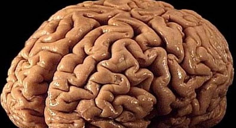 ___3816664___https:______static.pulse.com.gh___webservice___escenic___binary___3816664___2015___6___1___13___Things-must-be-known-about-brain-cancer