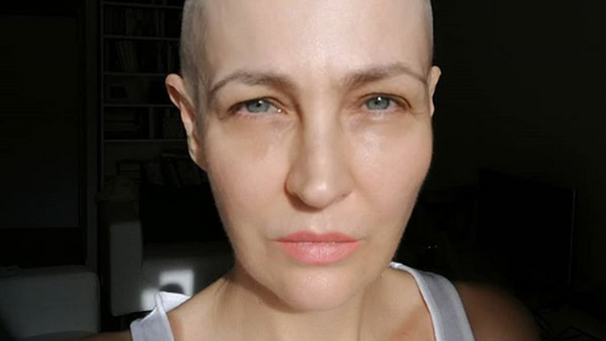 Anna Puślecka wywalczyła refundację leku na raka, ale... sama prawdopodobnie go nie dostanie