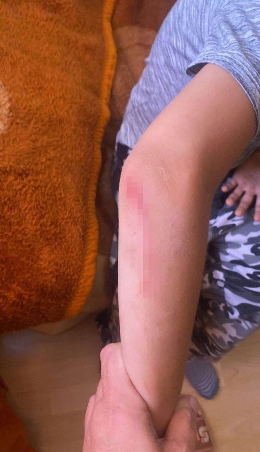 Dečak povređen u Šapcu