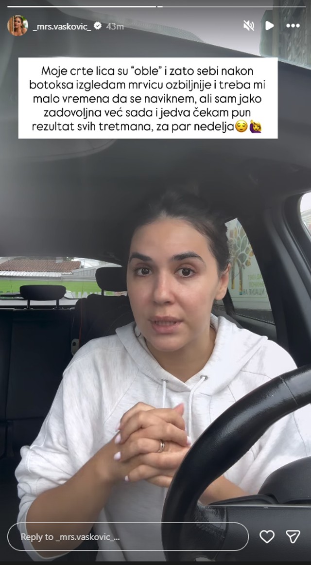 Aleksandra Vasković otkrila šta je sve radila na sebi