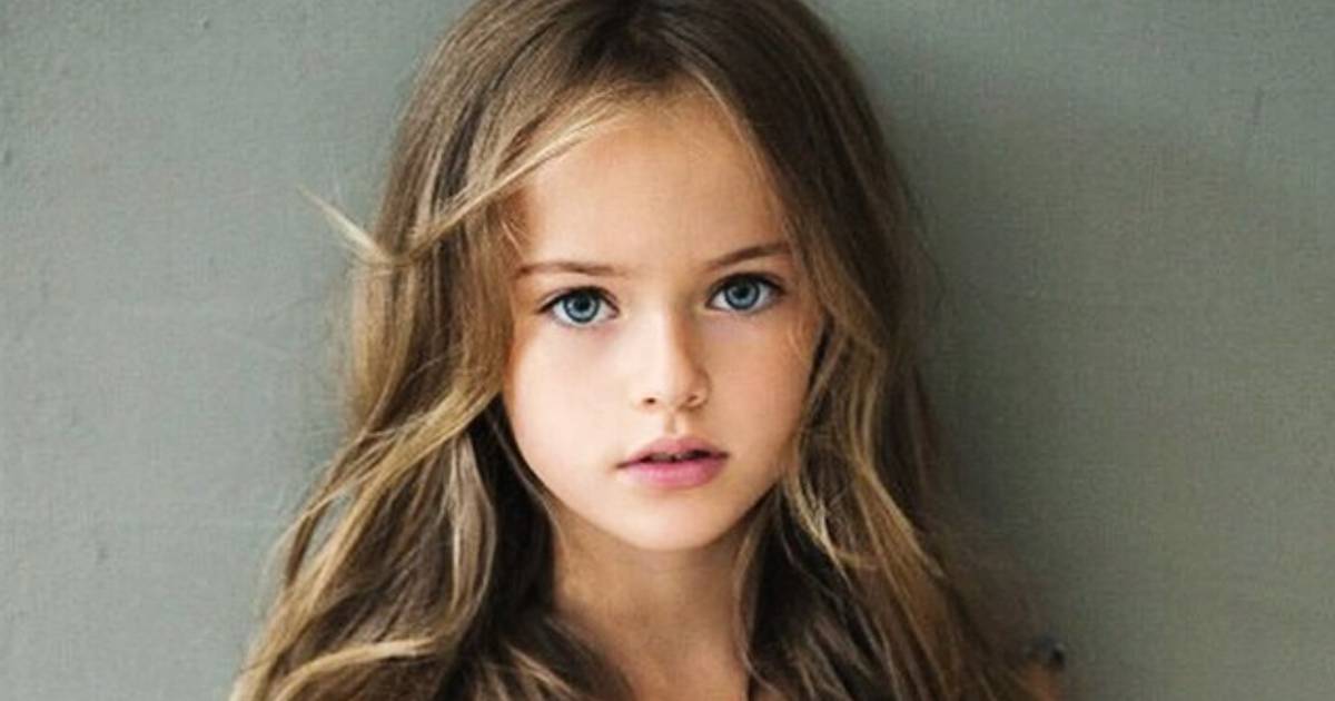 Nazywali ją "najpiękniejszą dziewczynką świata". Ma już 20 lat i tak wygląda