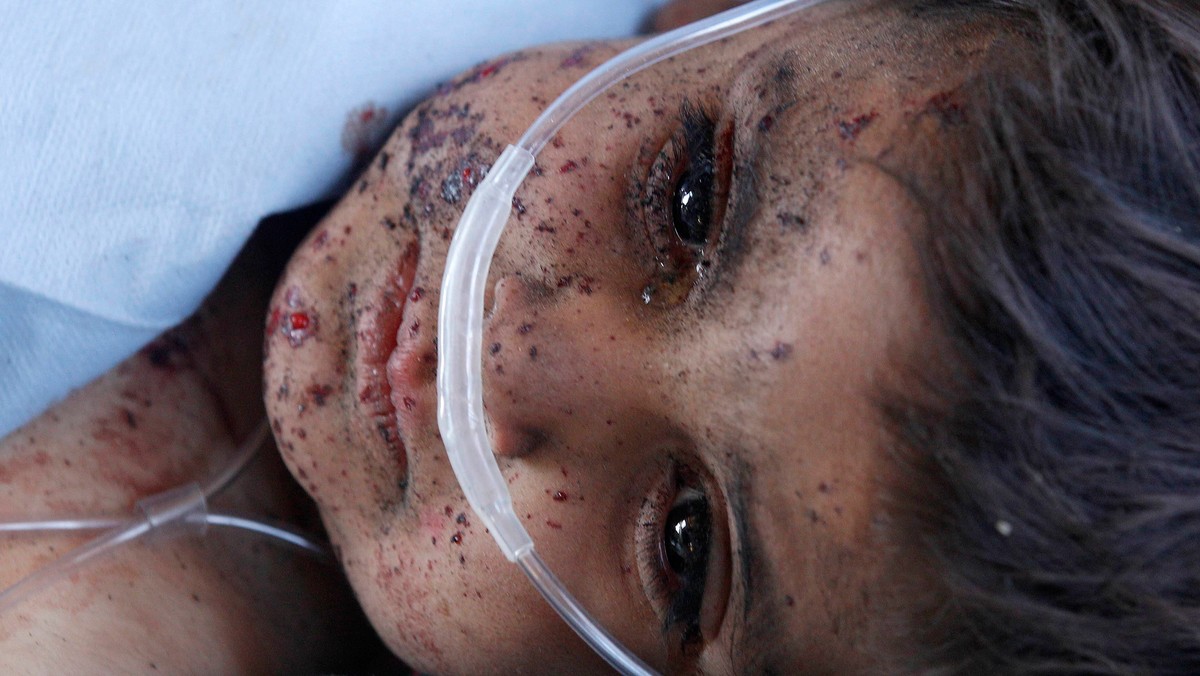 A child receives medical attention during a Medevac mission in southern Afghanistan's Helmand province November 13, 2010. The child was injured in an explosion.