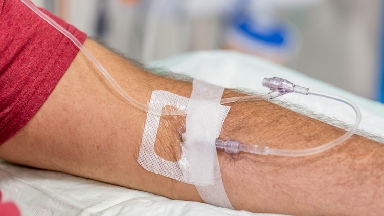immunoglobulin kezelés intravénás immunglobulin-terápia leírás