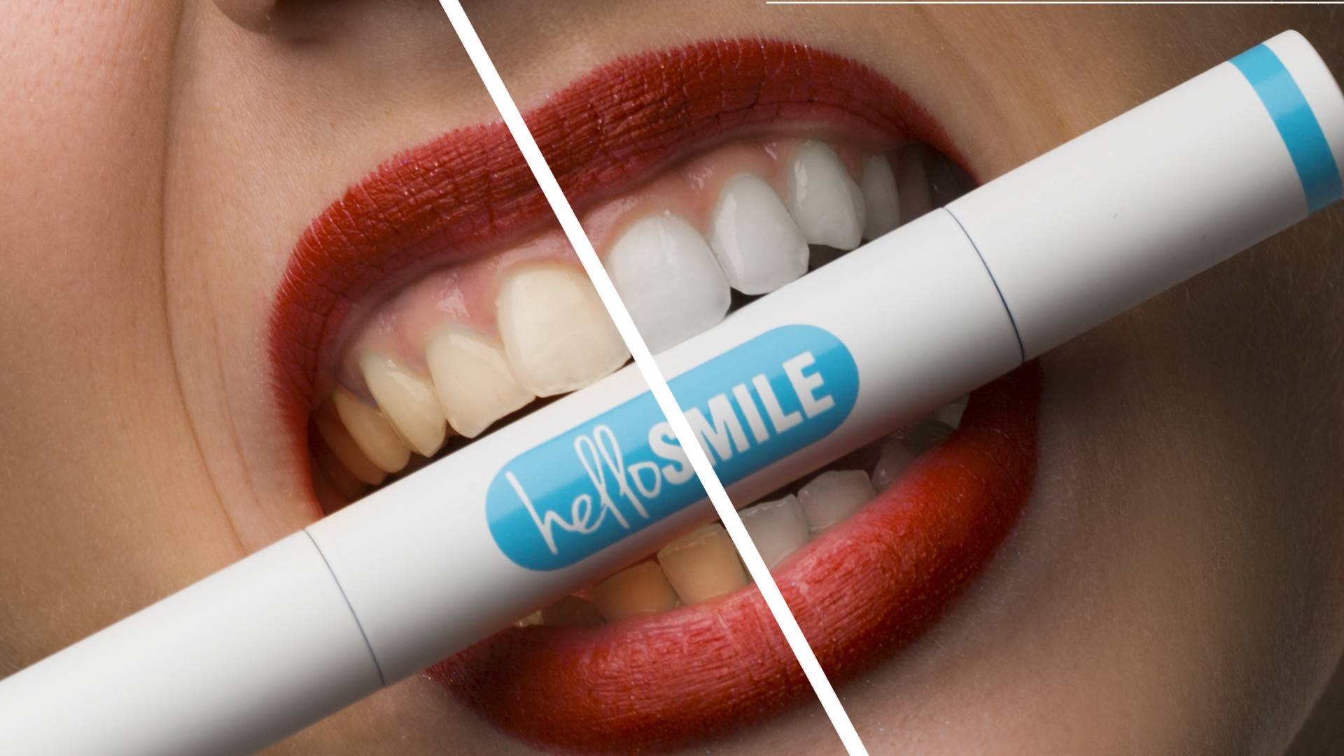 HelloSmile - izbelite zube uz pomoć olovke do željene nijanse