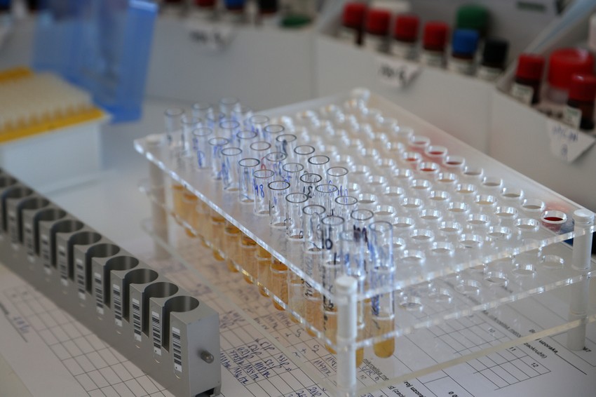 Put do dijagnoze je pravilno uzet urina