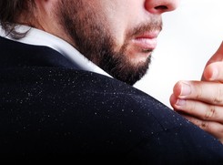 Nie daj się zarazić. Chroń się przed łupieżem