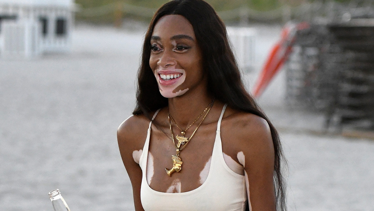 Winnie Harlow 