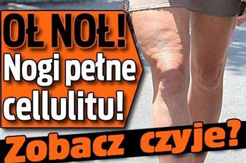 Oł noł! Nogi pełne cellulitu! Czyje?