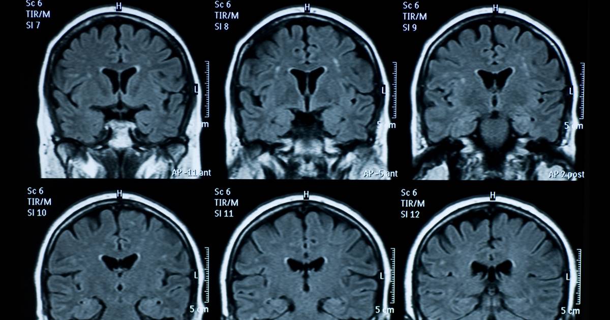 11-dimensional structures are designed by our brains so that we can make sense of the world