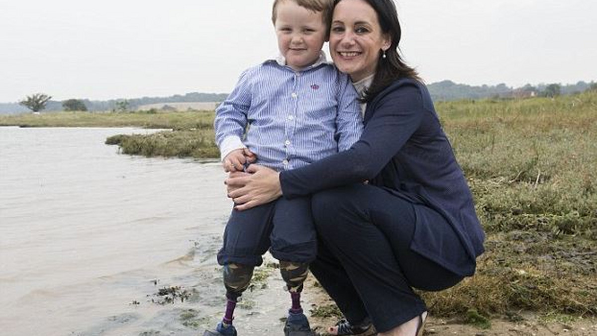Reuben to trzyletni chłopczyk, który pochodzi z Wielkiej Brytanii i na pozór niczym nie różni się od swoich rówieśników. Niestety rok wcześniej chłopiec oparzył się podczas zabawy w domu i przez błędną diagnozę lekarzy stracił obie nogi, a także siedem palców u rąk.