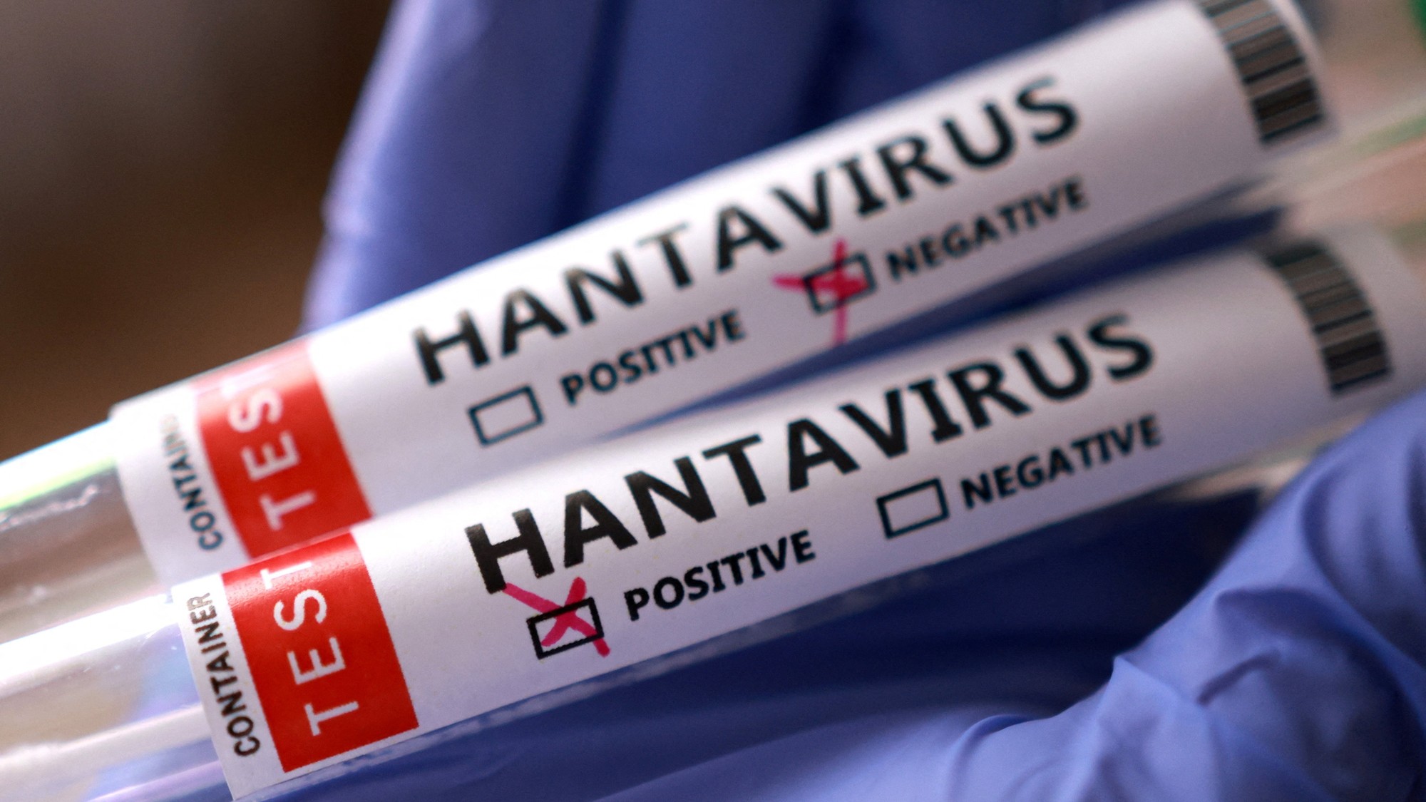 Na palube luxusnej výletnej lode bol zistený nebezpečný hantavírus.