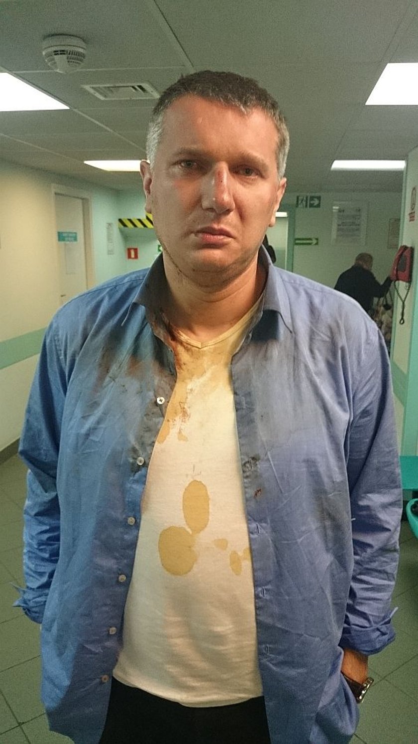 Poseł Przemysław Wipler ujawnił obdukcję