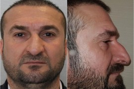 Turci, ALAL VERA MAJSTORI! Hirurzi mu bukvalno 'NAPRAVILI NOVO LICE', moraće da vadi i NOVA DOKUMENTA: Od sredovečnog 'ČIKICE' stvorili su 'GLAVNOG GLUMCA' i srcelomca