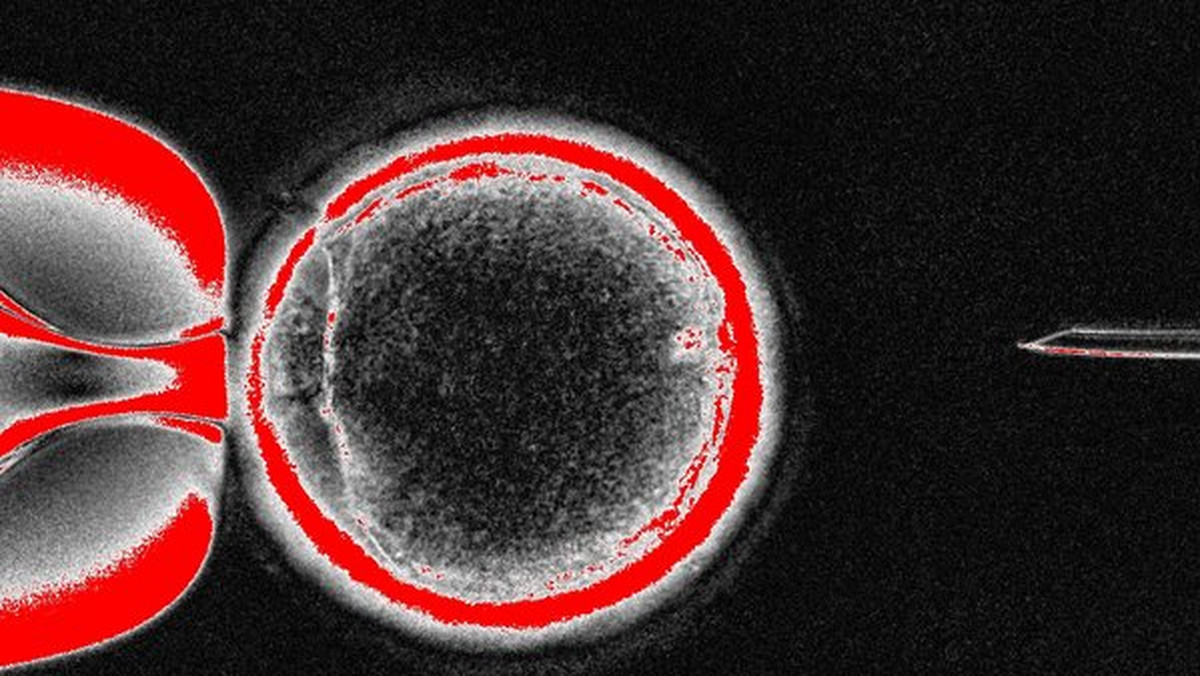 Badacze sklonowali ludzkie zarodki metodą Dolly, z których po raz pierwszy można pozyskać komórki macierzyste. Otwiera to nowe możliwości hodowli tkanek i narząd, ale budzi również ogromne kontrowersje etyczne.