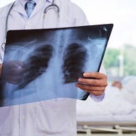 Tüdőgyulladás típusai, tünetei, kezelése és szövődményei