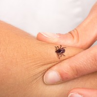Így tette tönkre a Lyme-kór a fiatal nő életét – nem vette komolyan a lábán megjelenő piros foltot