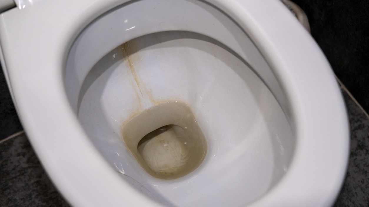 Vodný kameň v toalete sa môže objaviť aj napriek pravidelnému čisteniu. Časom vytvára tvrdý povlak, ktorý sa odstraňuje čoraz ťažšie.