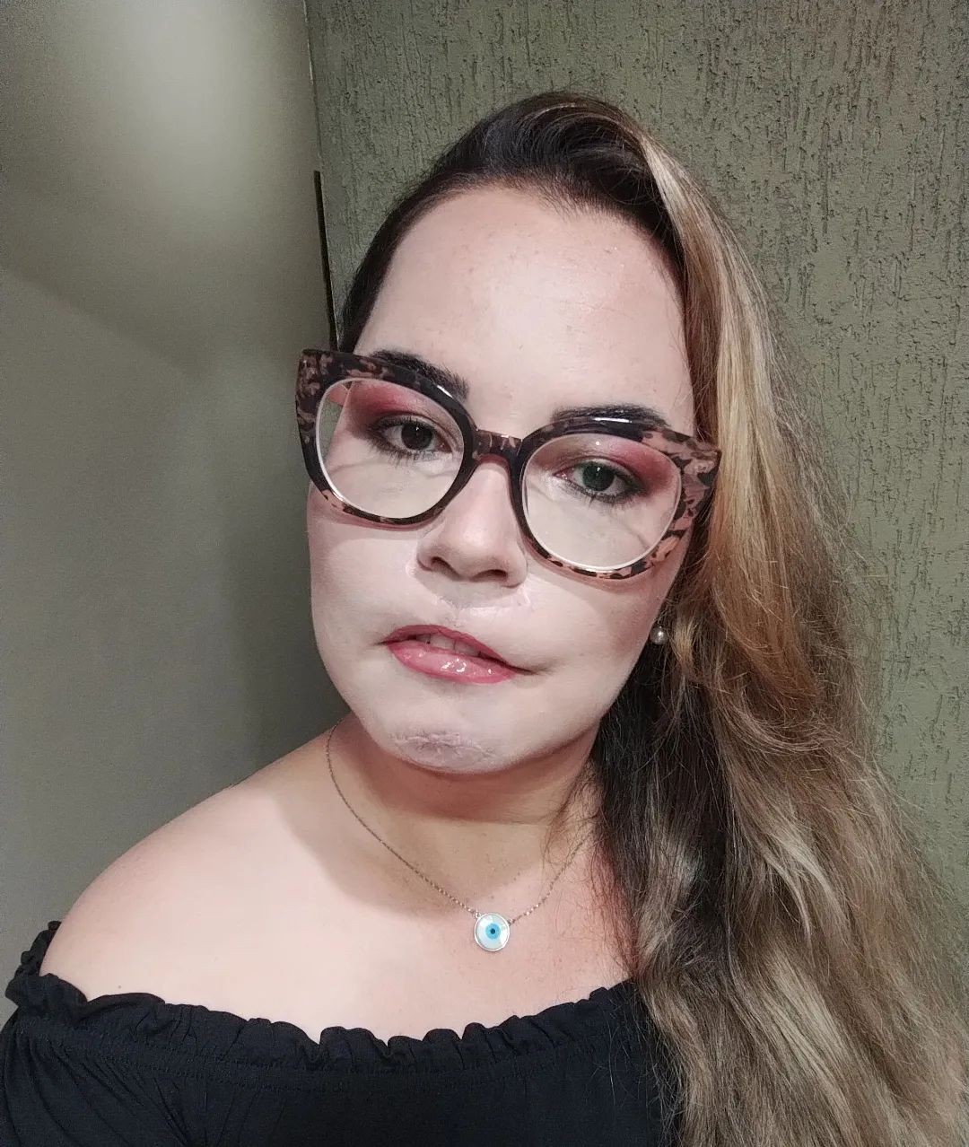 Krásna Mariana ostala so znetvorenou tvárou.