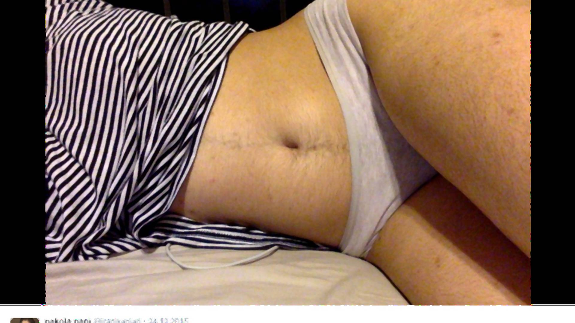 Dziewczyna pokazała zdjęcia owłosionego brzucha, podzieliła internautów. Większość ją masakruje