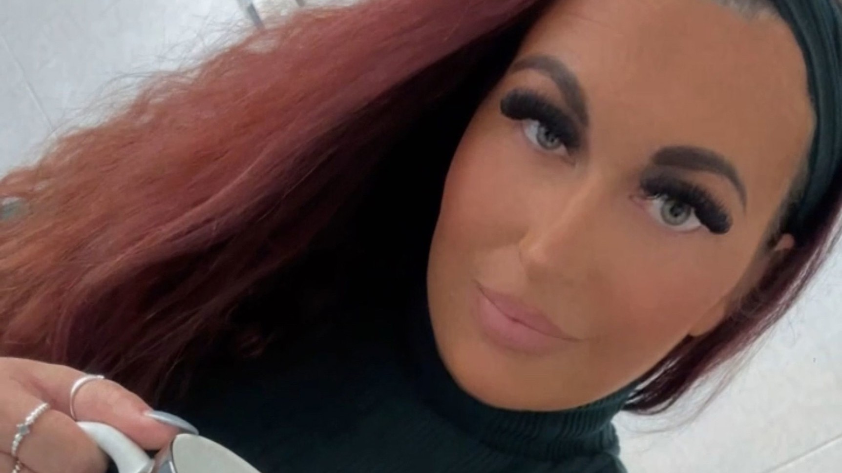 Jenny nemala žiadne ďalšie príznaky.