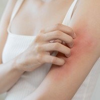 Parlagfű allergia: ezek a szem- és bőrtünetek is jelezhetik