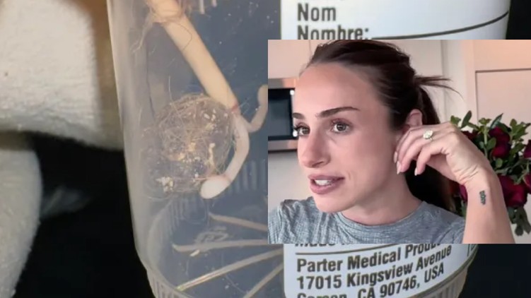 spirál köré tekeredett szőr