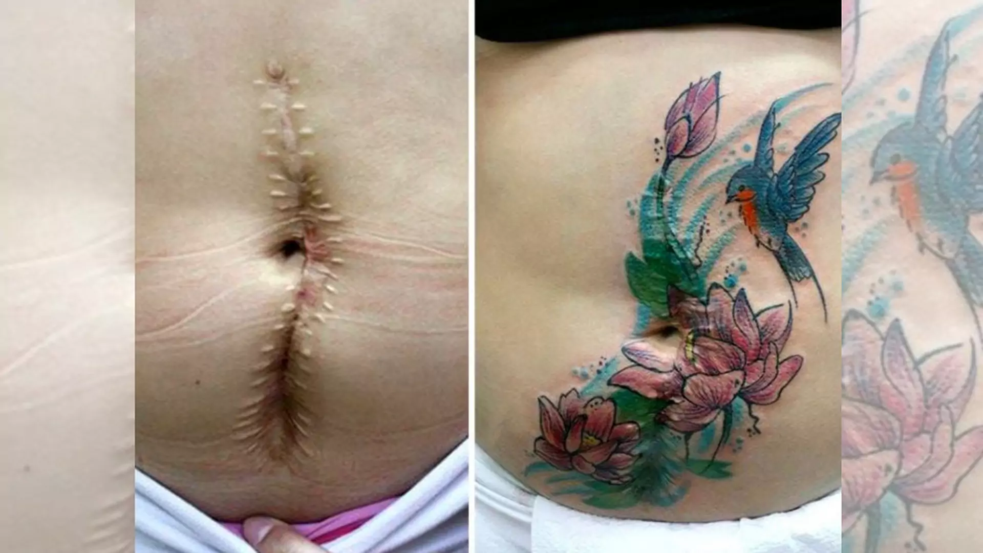 Szpecące blizny zakrywa pięknymi tatuażami, by kobiety dotknięte przemocą zapomniały o swojej traumie