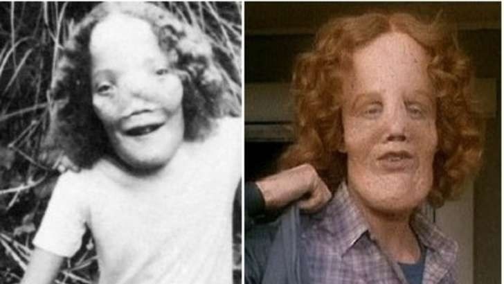 Rocky Dennis